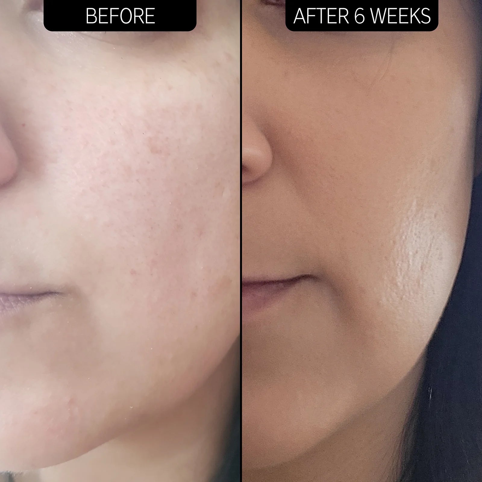 Urea Moisturizer 10% - MazenOnline