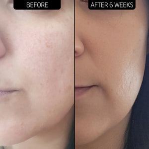 Urea Moisturizer 10% - MazenOnline