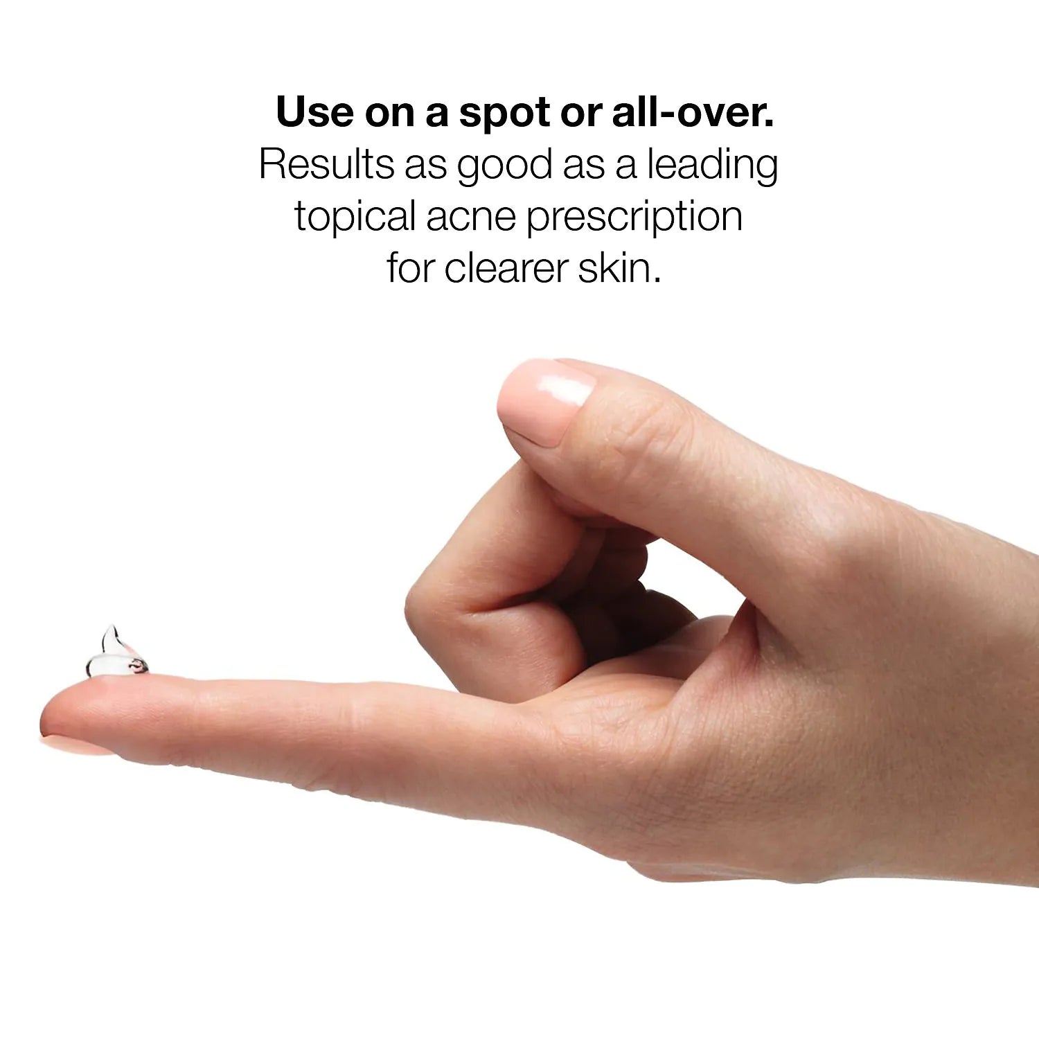 clinique acne solutions gel