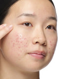 Aloe 2%+ NAG 2% Solution - MazenOnline