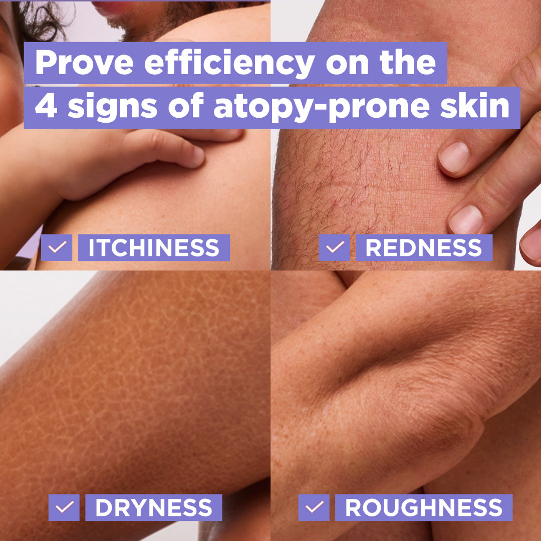 Panthenol Comfort Cream Jar - Anti-Scratching Cream - For Dry Skin, Atopy Prone Skin and Eczema - For Face, Hands & Body