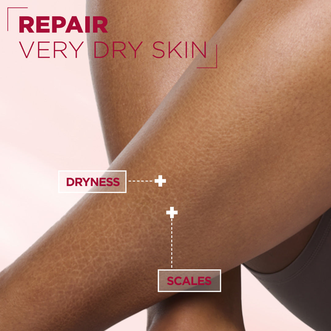 Urea Cica Repair Cream Jar - For Keratosis Pilaris, Dry Rough Fragile Skin & Tiny Reddish Bumps - For Face, Hands & Body