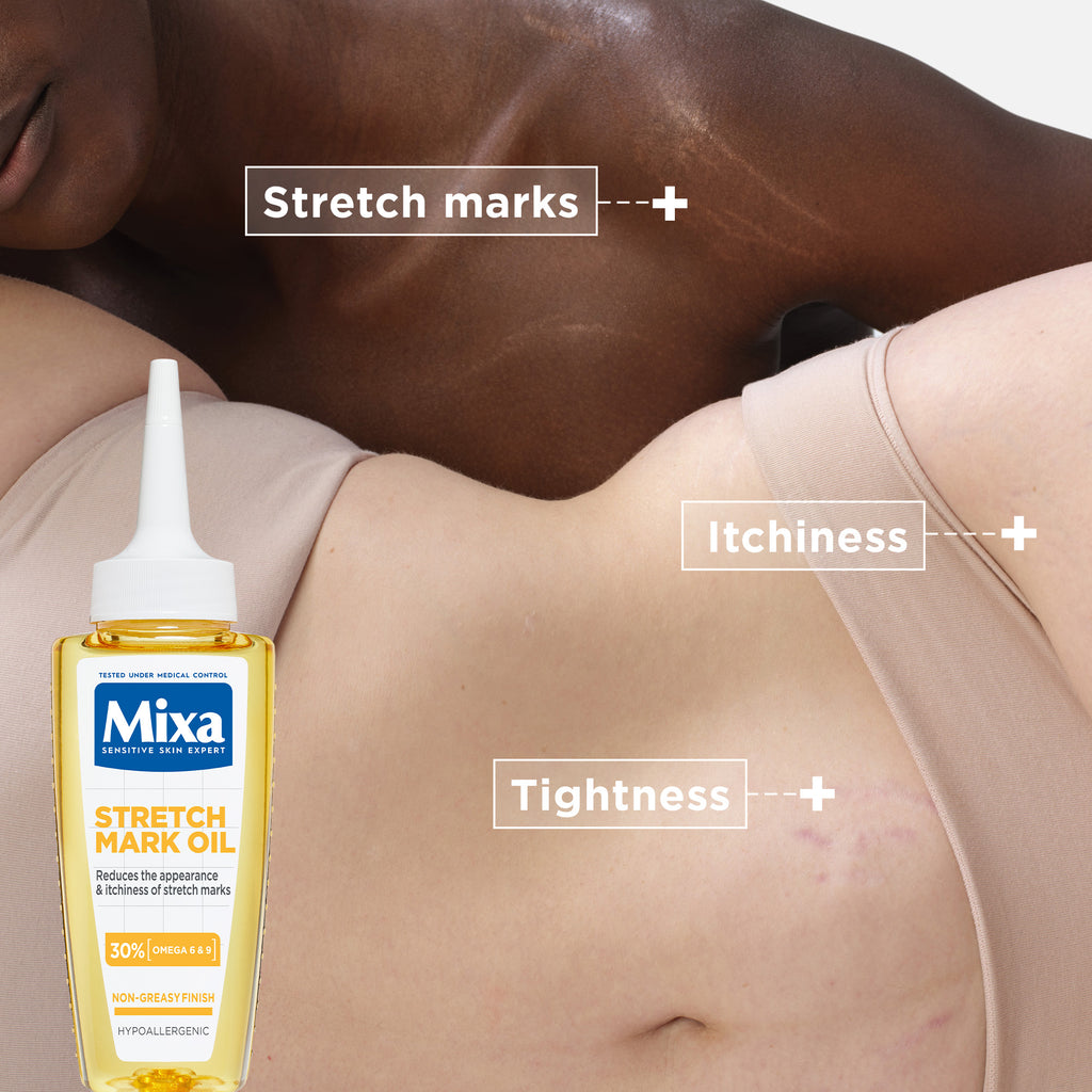 Mixa - Anti Stretch Mark Oil - For Skin with Stretch Marks - With Omega 6 & 9 | MazenOnline
