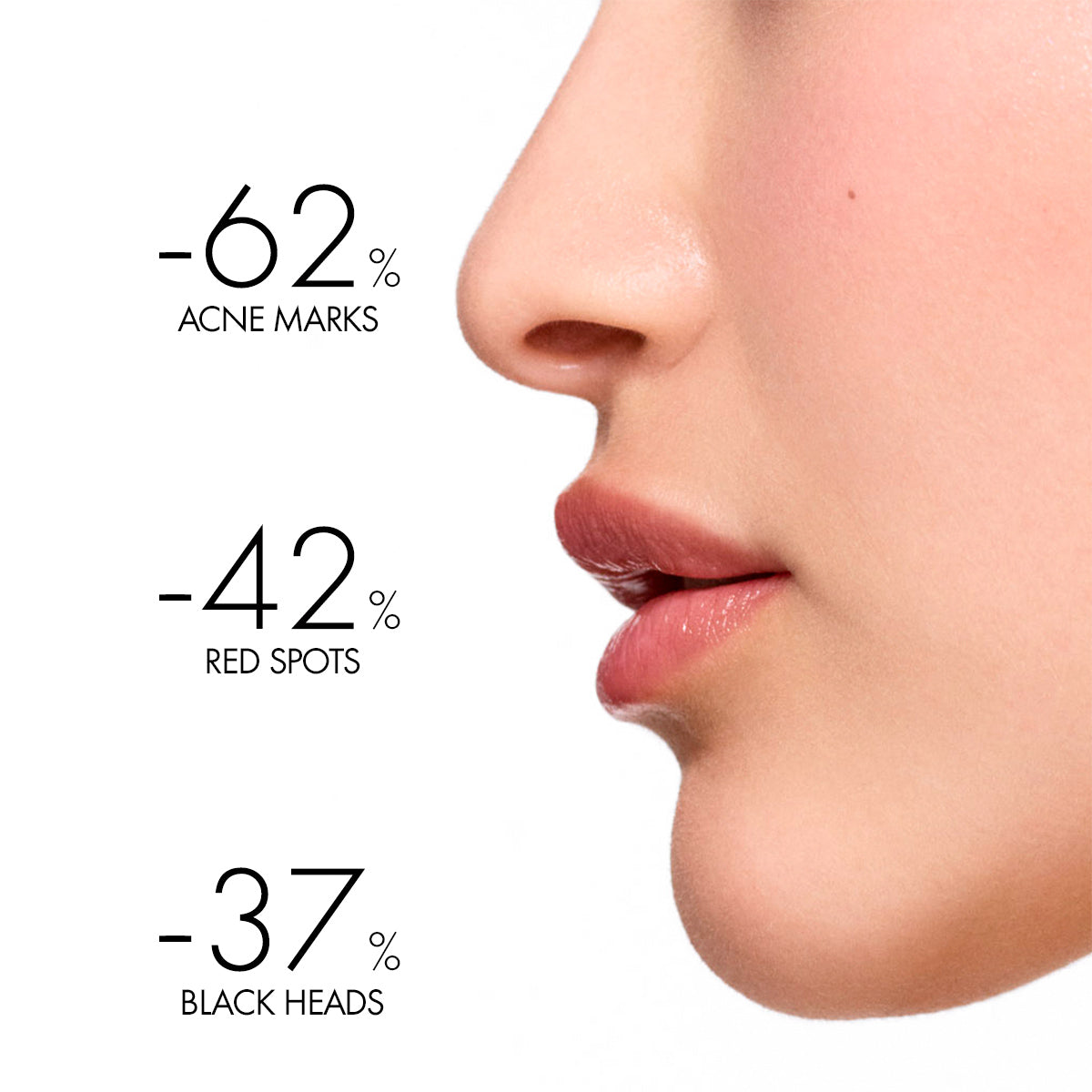 Normaderm Phytosolution