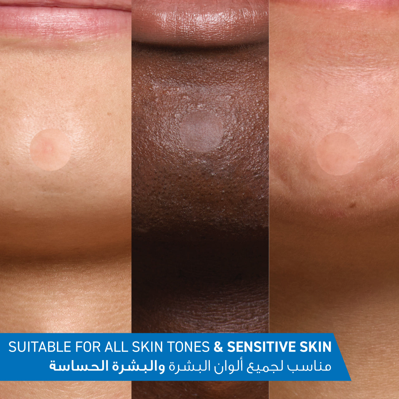 Blemish Barrier Patches - MazenOnline