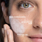 Effaclar Acne Foaming Cleansing Gel for Oily and Acne Prone Skin