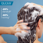 Buy Two Get One Kelual DS Anti-dandruff treatment shampoo 100ml