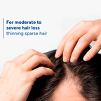 Buy Ducray Neoptide Expert Anti-hair loss & growth serum & get a FREE 100ml Anaphase anti-thinning shampoo