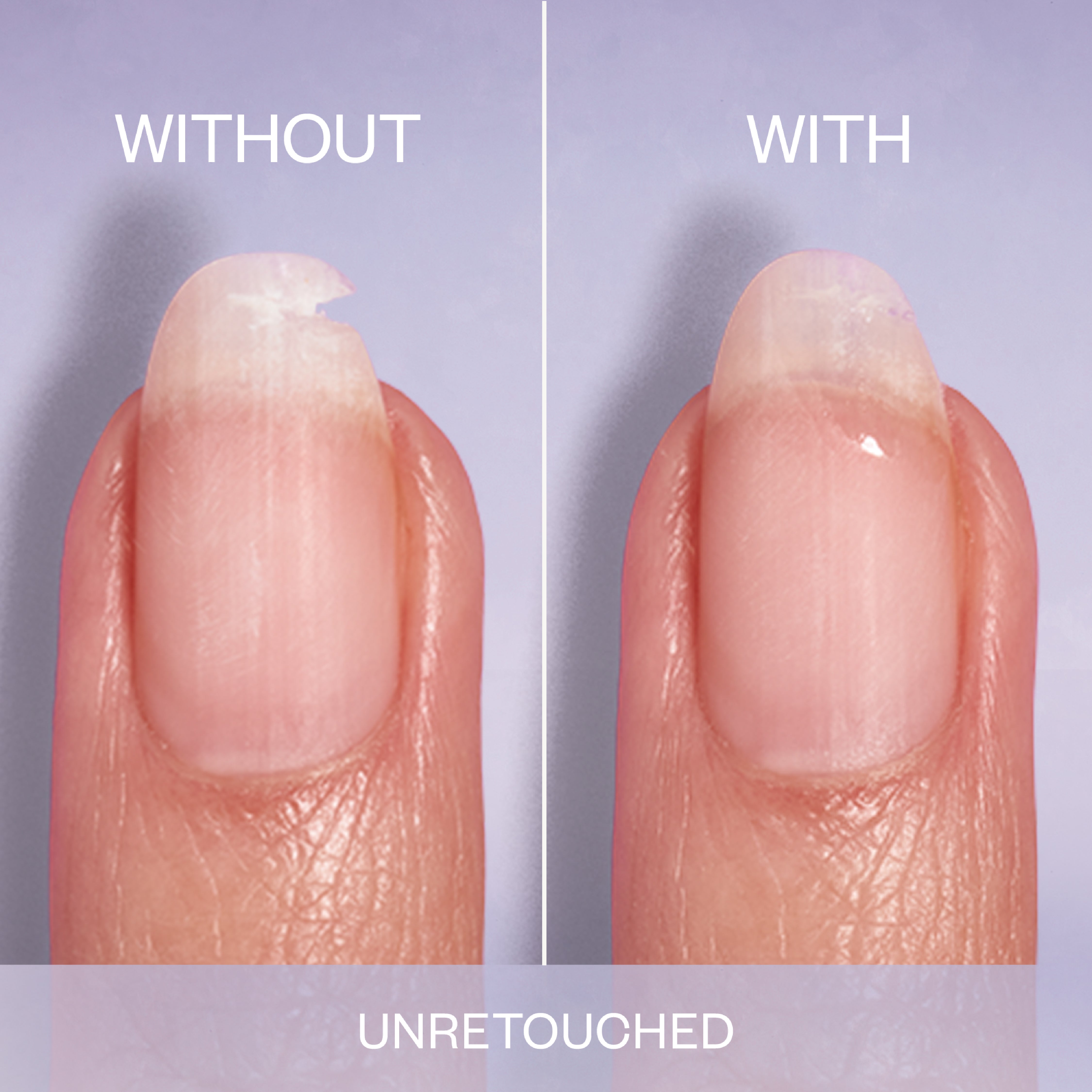 Essie - Essie Break Fix Liquid Nail Care and Treatment Patch | MazenOnline