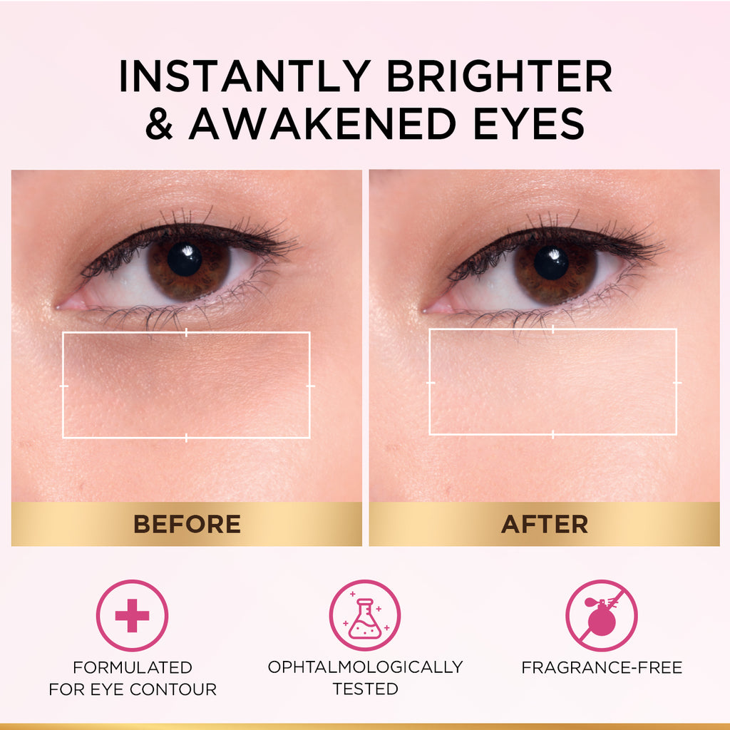 L'Oréal Paris - Glycolic Bright Eye Serum, with 3% (Glycolic Acid  + Vitamin CG + Niacinamide], for Dark Circles and Under Eyes Brightening | MazenOnline