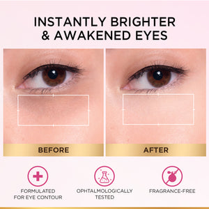 L'Oréal Paris - Glycolic Bright Eye Serum, with 3% (Glycolic Acid  + Vitamin CG + Niacinamide], for Dark Circles and Under Eyes Brightening | MazenOnline