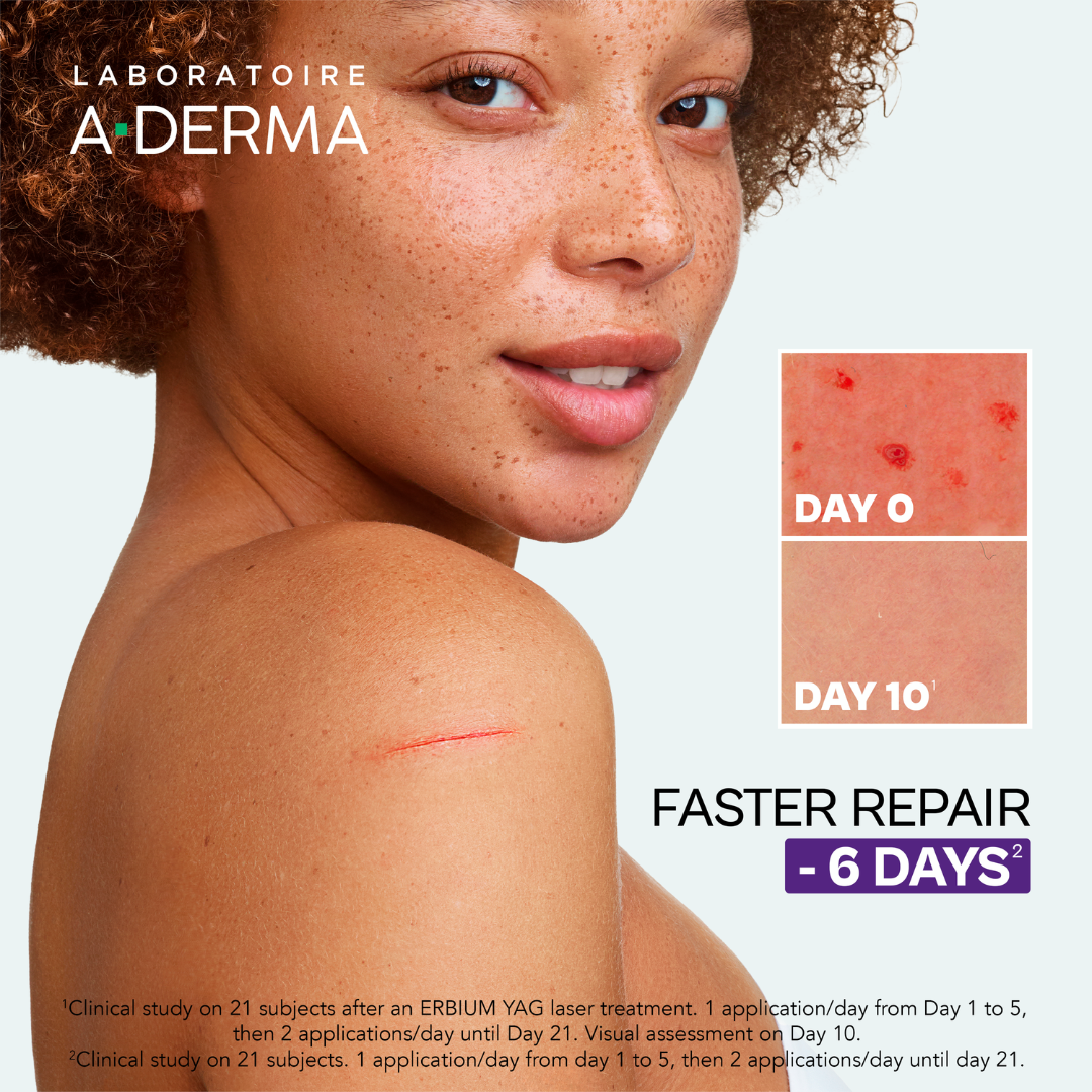 Aderma - Buy one A-Derma Epitheliale AH Ultra Anti-mark Repairing Cream and get a FREE 50ml A-Derma hand and nails cream | MazenOnline