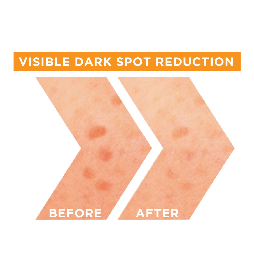 Garnier - Fast Bright Vitamin C + Niacinamide 30x Brightening Booster Serum | MazenOnline