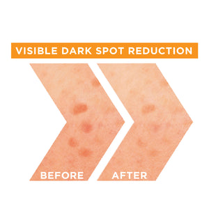 Garnier - Fast Bright Vitamin C + Niacinamide 30x Brightening Booster Serum | MazenOnline