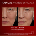 Revitalift Triple Power Age-Correcting™ Serum with Tri-peptides, Hyaluronic Acid, and Vitamin C to Hydrate, Tone, and Firm Skin