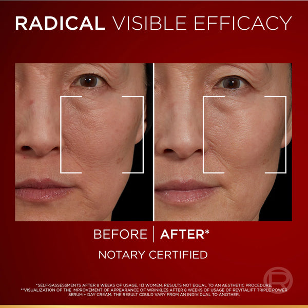 Revitalift Triple Power Age-Correcting™ Serum with Tri-peptides, Hyaluronic Acid, and Vitamin C to Hydrate, Tone, and Firm Skin