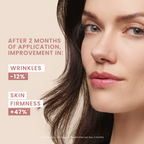 Hyaluron Activ Procedure Retinal Lifting Cream - 0.1% Retinal - MazenOnline