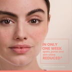 Cleanance Comedomed Intensive Anti-Blemish treatment 30ml