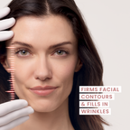 Avène Hyaluron Activ Micro-Lift Eye & Lip Cream
