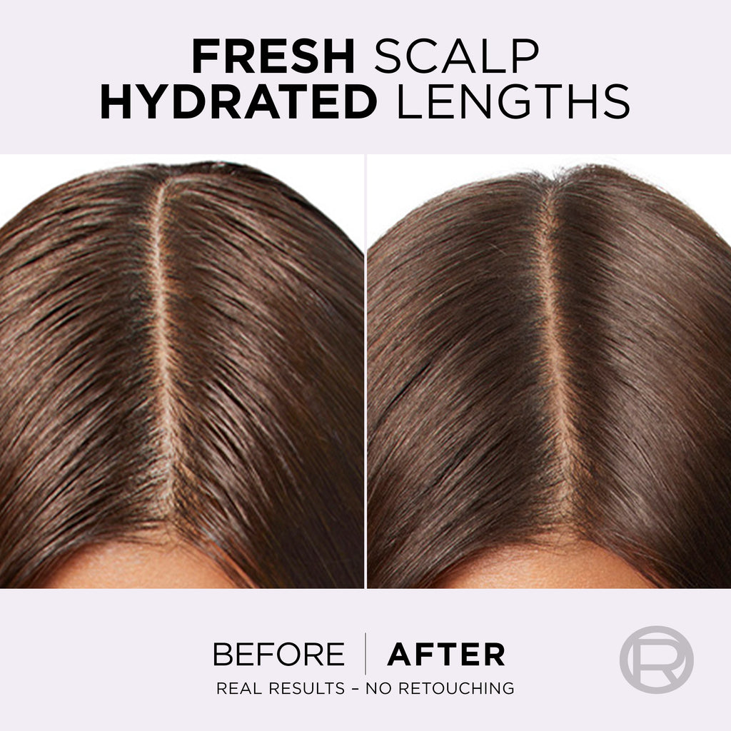 Elvive - Hyaluron Pure Oil Erasing Scalp Serum with Salicylic Acid | MazenOnline