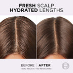 Elvive - Hyaluron Pure Oil Erasing Scalp Serum with Salicylic Acid | MazenOnline