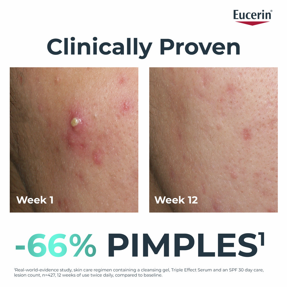 DermoPurifyer Triple Effect Serum