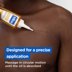 Mixa - Anti Stretch Mark Oil - For Skin with Stretch Marks - With Omega 6 & 9 | MazenOnline
