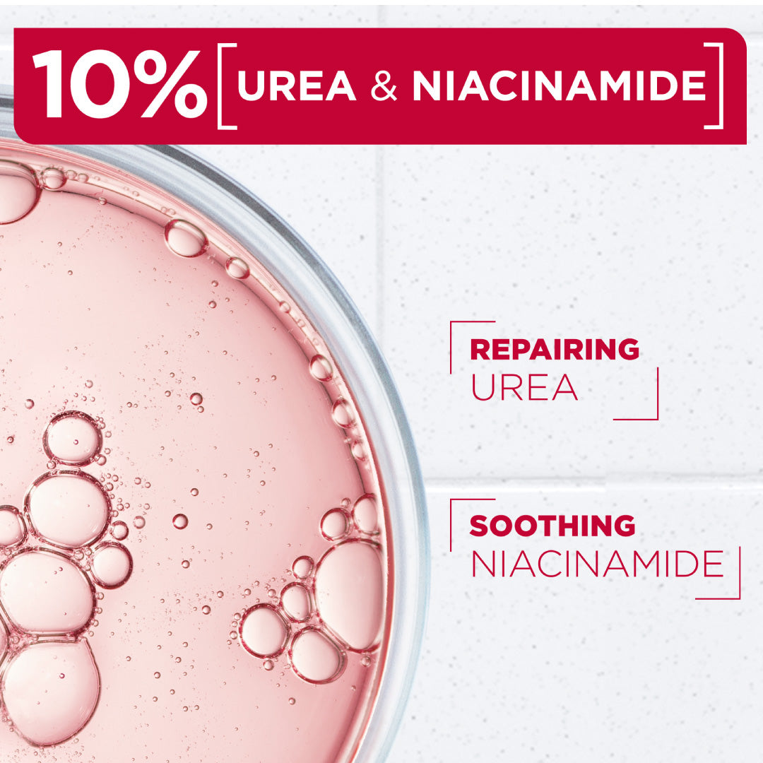 Mixa - Urea Cica Repair Cream Jar - For Keratosis Pilaris, Dry Rough Fragile Skin & Tiny Reddish Bumps - For Face, Hands & Body | MazenOnline