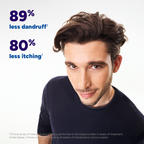 Kelual DS Original Treatment Shampoo for severe dandruff - MazenOnline