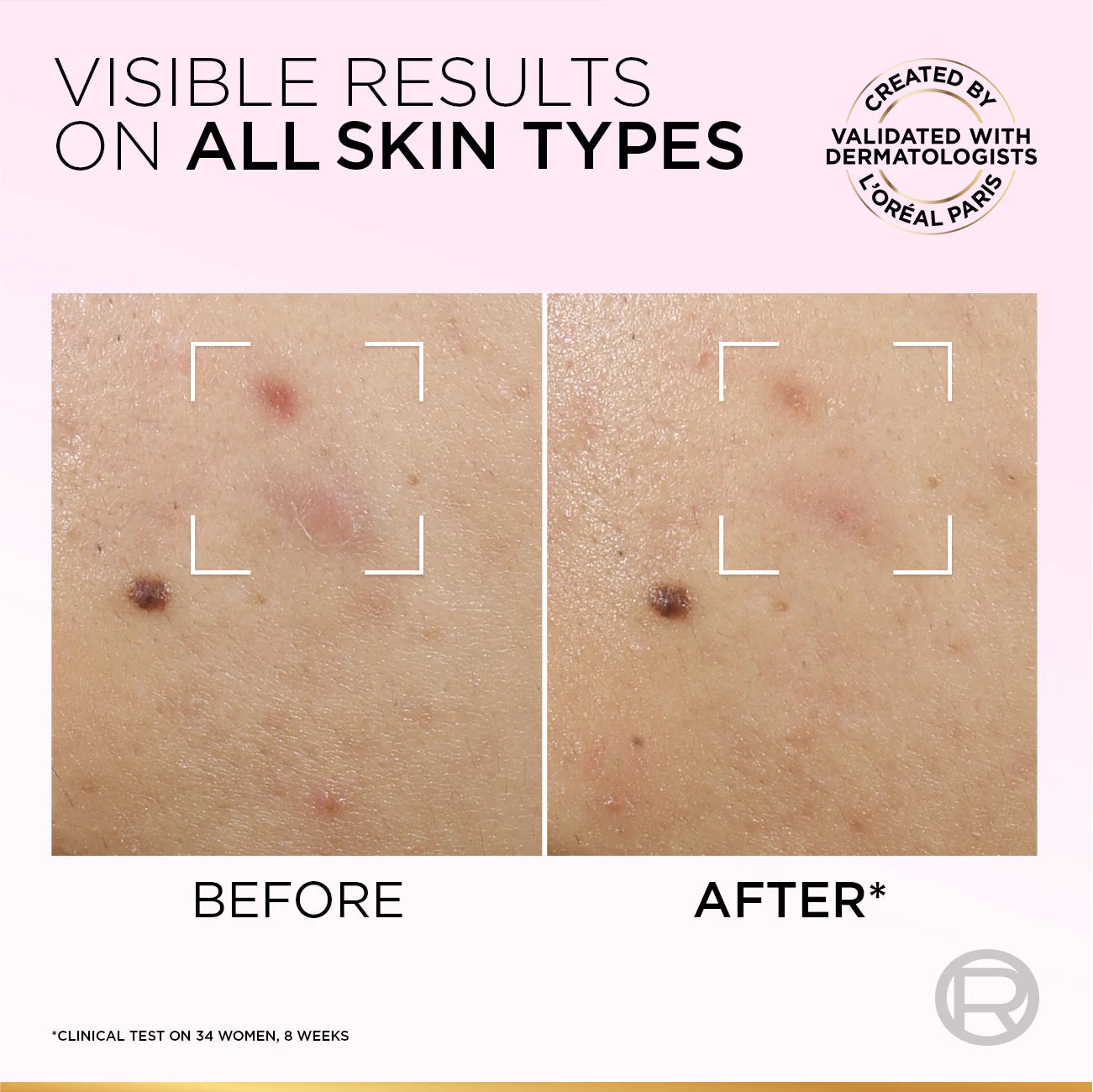 Glycolic-Bright Anti-Dark Spot Exfoliant Peel 15% AHA + BHA + PHA + Niacinamide - MazenOnline