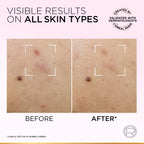 Glycolic-Bright Anti-Dark Spot Exfoliant Peel 15% AHA + BHA + PHA + Niacinamide - MazenOnline
