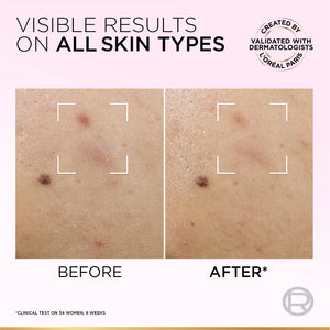 Glycolic-Bright Anti-Dark Spot Exfoliant Peel 15% AHA + BHA + PHA + Niacinamide - MazenOnline