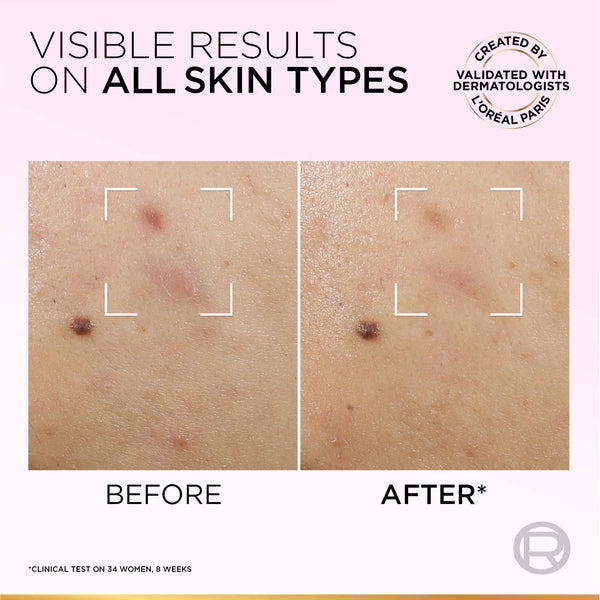 Glycolic-Bright Anti-Dark Spot Exfoliant Peel 15% AHA + BHA + PHA + Niacinamide - MazenOnline