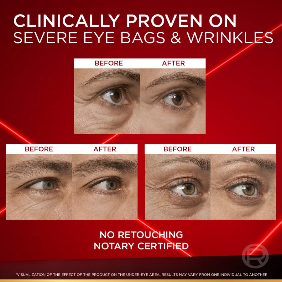 Revitalift Laser Eye Bag Instant Eraser