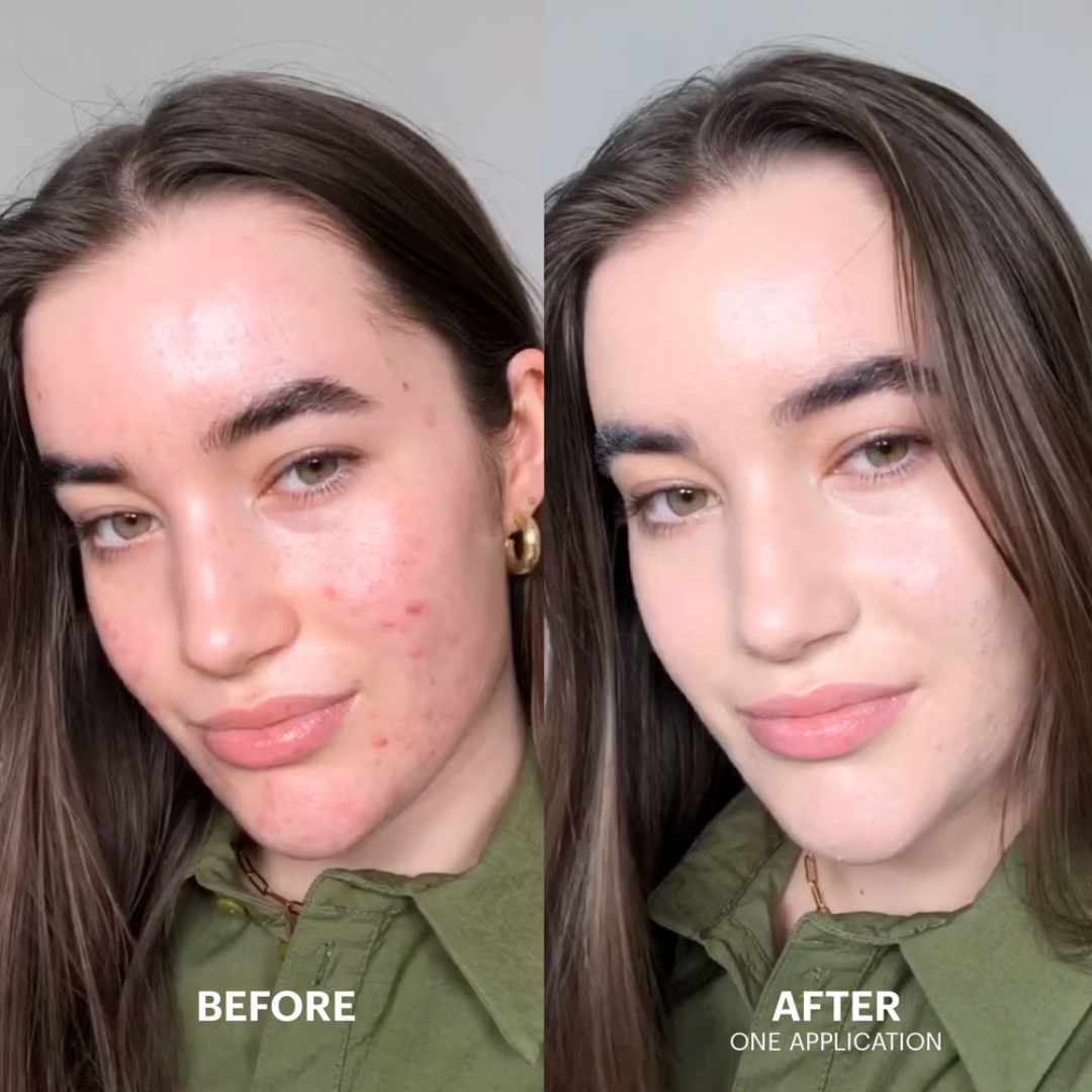 Cicapair™ Tiger Grass Color Correcting Treatment Spf 30 Secondary image