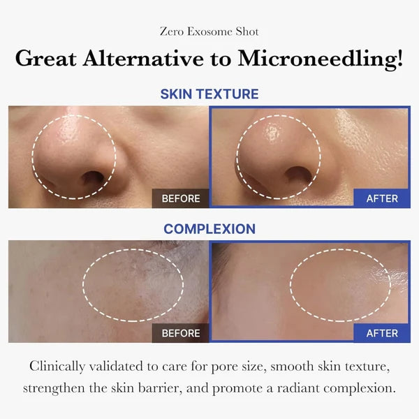 One-Day Exosome Shot Pore Ampoule