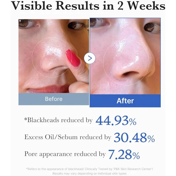 Zero Pore Pad