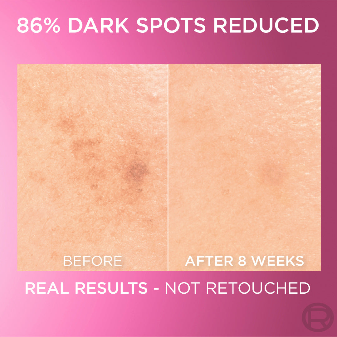 L'Oréal Paris - Glycolic Bright Serum with 8% [Melasyl ™ + Glycolic Acid + Niacinamide] face serum for Dark Spots & Brightening | MazenOnline