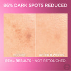 L'Oréal Paris - Glycolic Bright Serum with 8% [Melasyl ™ + Glycolic Acid + Niacinamide] face serum for Dark Spots & Brightening | MazenOnline