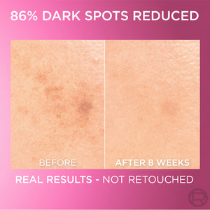 L'Oréal Paris - Glycolic Bright Serum with 8% [Melasyl ™ + Glycolic Acid + Niacinamide] face serum for Dark Spots & Brightening | MazenOnline