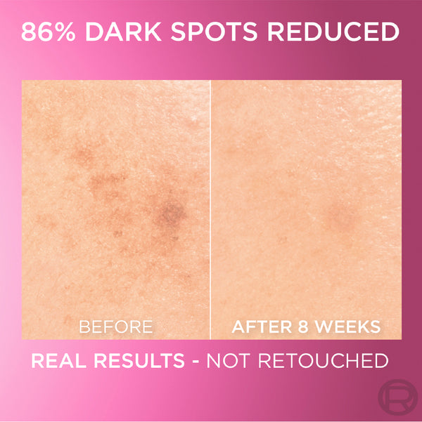 L'Oréal Paris - Glycolic Bright Serum with 8% [Melasyl ™ + Glycolic Acid + Niacinamide] face serum for Dark Spots & Brightening | MazenOnline