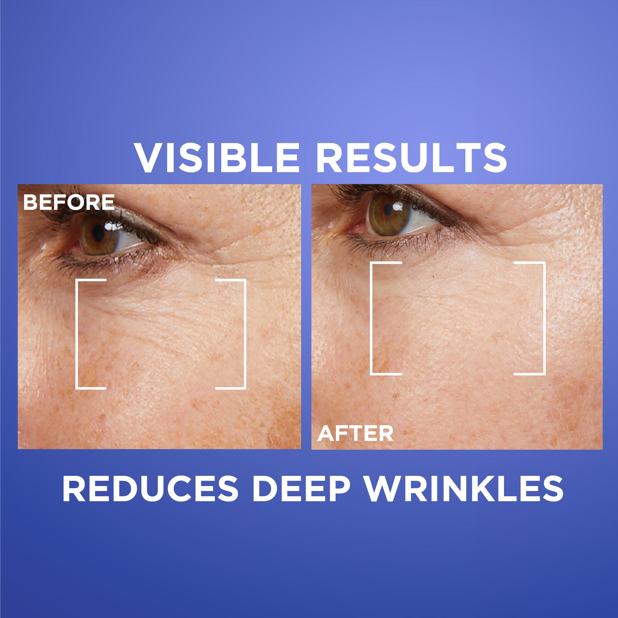 L'Oréal Paris - Revitalift Retinol Night Serum For Face, With 0.2% Pure Retinol, Moisturizes Skin and Eliminates Deep Wrinkles, For All Skin Types | MazenOnline