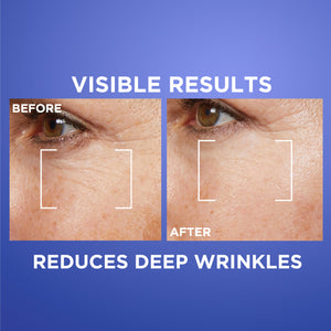 L'Oréal Paris - Revitalift Retinol Night Serum For Face, With 0.2% Pure Retinol, Moisturizes Skin and Eliminates Deep Wrinkles, For All Skin Types | MazenOnline