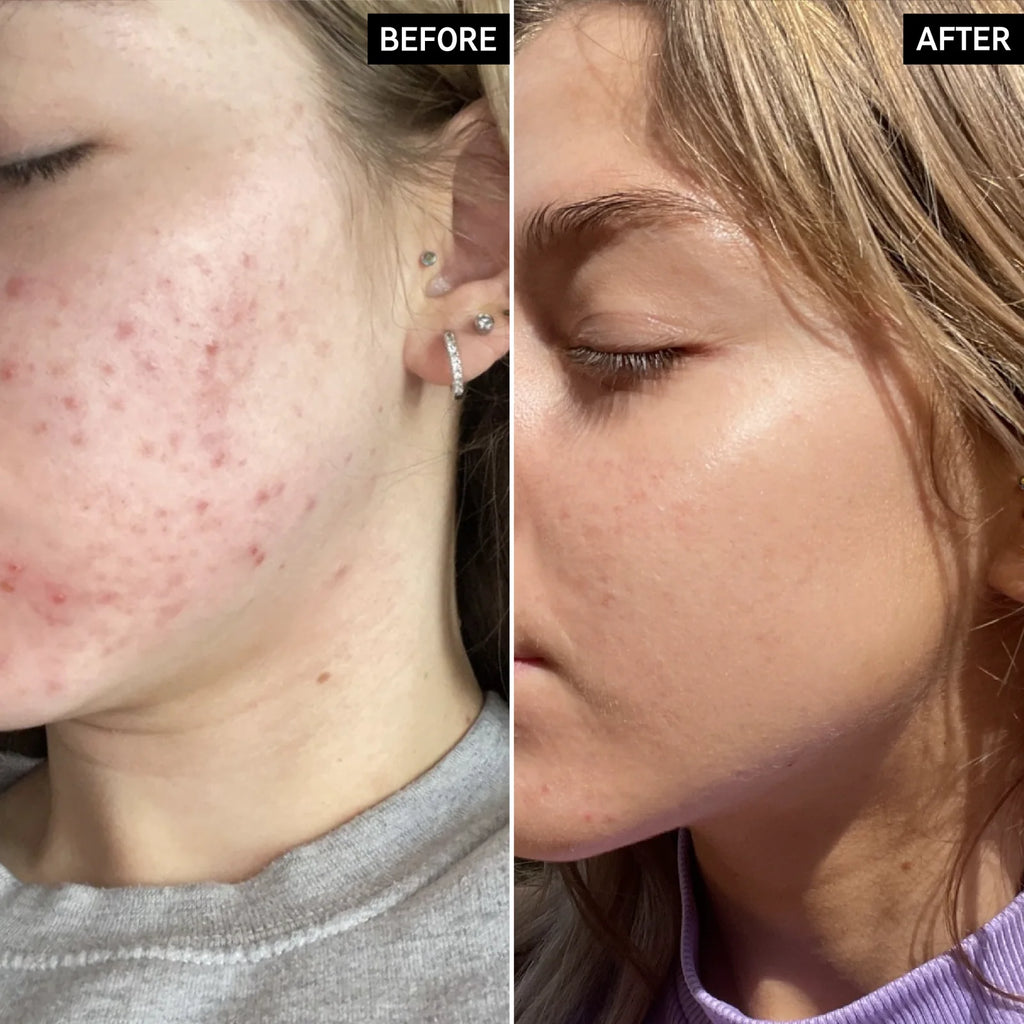 the inkey list niacinamide