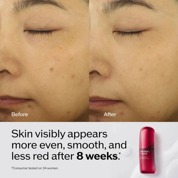 Ultimune Power Infusing Serum