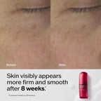 Ultimune Power Infusing Serum