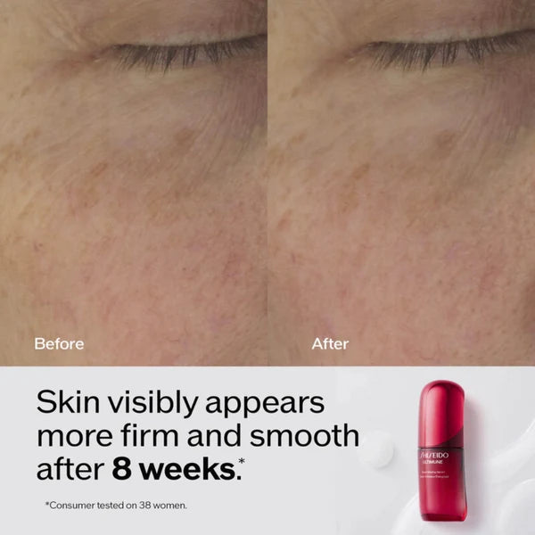 Ultimune Power Infusing Serum