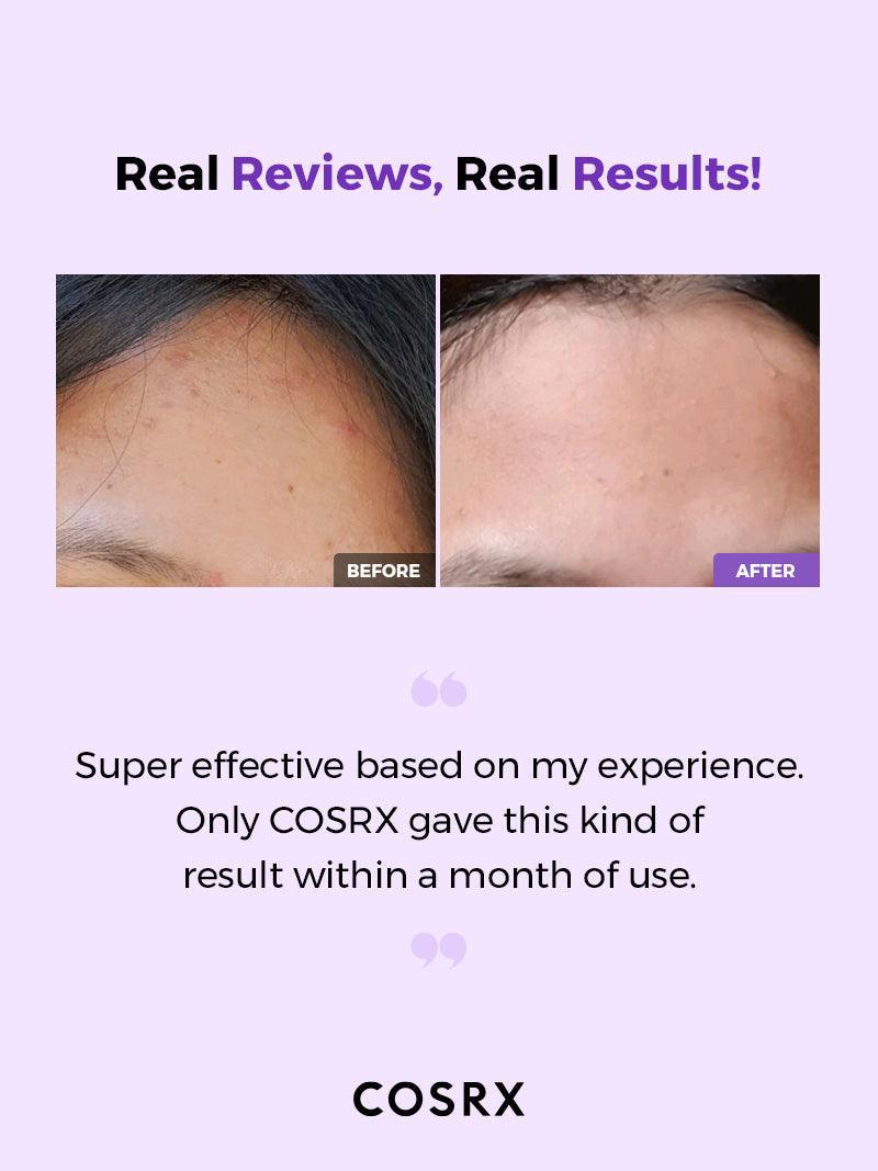 COSRX - AHA/BHA Clarifying Treatment Toner | MazenOnline