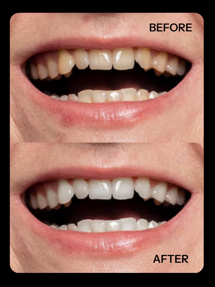 Ivora Essentials - Teeth Whitening Serum | MazenOnline