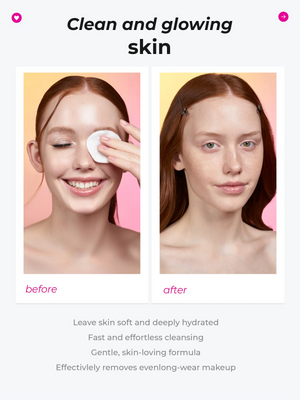 MISOMI BEAUTY - Micellar Water | MazenOnline